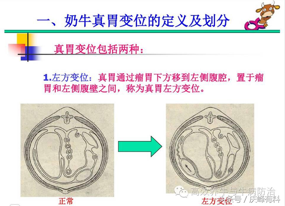 奶牛真胃扩张的症状治疗方法,奶牛皱胃左方变位治疗方法