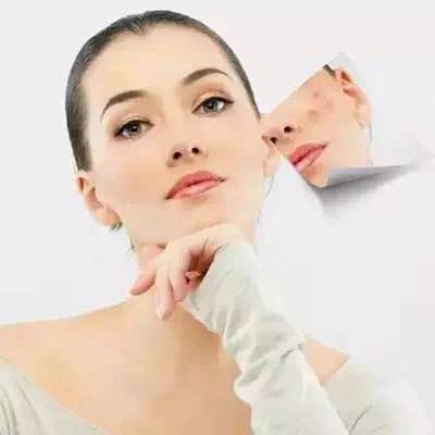 挤了多年的痘痘，你知道挤出来白色的物体是什么吗？