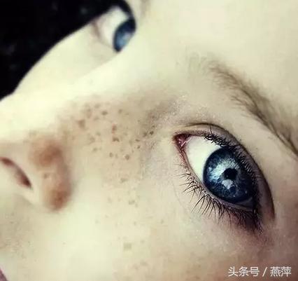 祛斑10年的真实经历,祛斑真实的经历