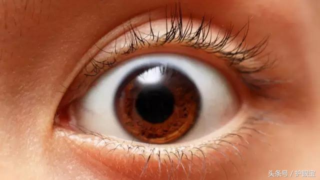 眼内有血丝且容易疲劳,眼白处的血丝一直消不掉
