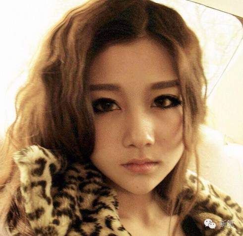 双眼皮变脸真实案例,网红双眼皮最成功的