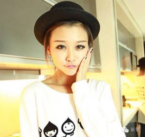 双眼皮变脸真实案例,网红双眼皮最成功的