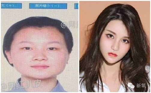 双眼皮变脸真实案例,网红双眼皮最成功的