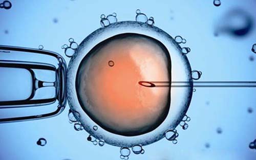 再造福！我国首例“核型定位PGD”试管婴儿诞生