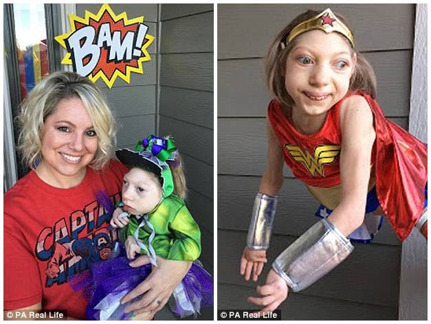 这位妈妈有两个患小头症的女儿,她家的画风是这样的