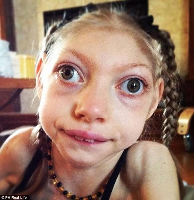 这位妈妈有两个患小头症的女儿,她家的画风是这样的