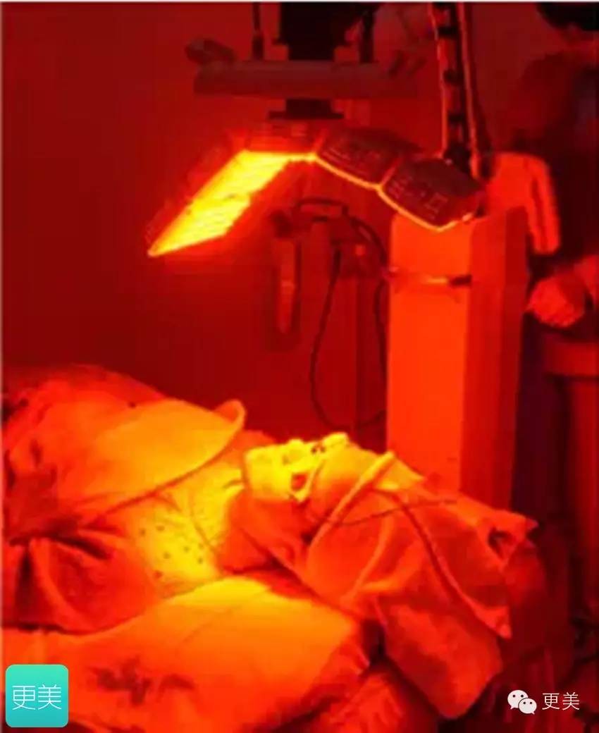 美容的红光有什么作用,红蓝光美容正确使用方法