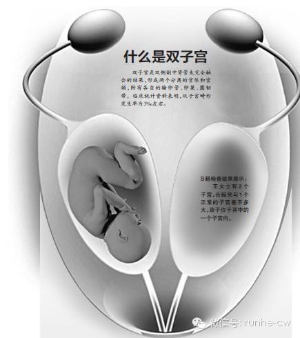 孕6月准妈妈肚子惊现两个子宫,跪求医生挽救不成竟被迫含泪引产