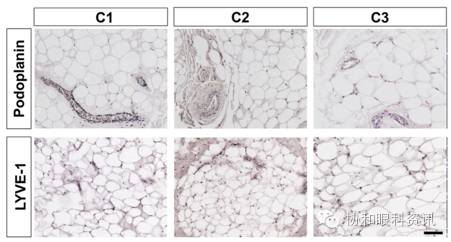 文摘速递TAO眶压升高，谁是幕后元凶？