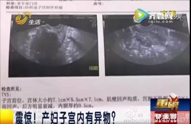 “纱布落在孕妇肚子里”？！其实是一场*局骗**！真是一出好戏啊！