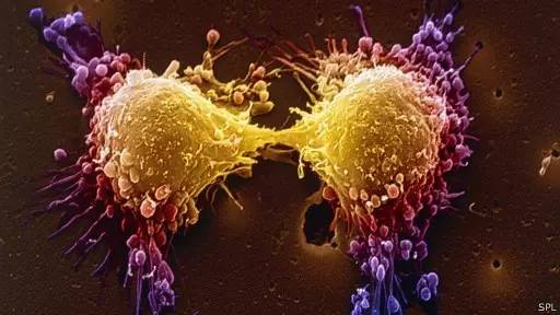 滚蛋吧肿瘤君全集,滚蛋吧肿瘤君高清完整版在线观看