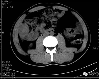 鐥呯悊鍒囩墖闃呯墖澶ц禌,鐥呯悊闃呯墖姣旇禌