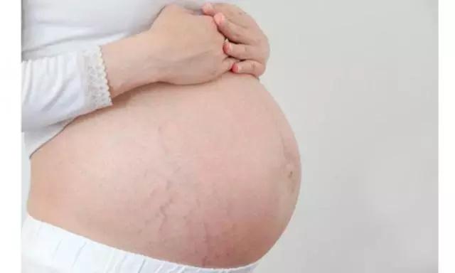 为什么明星产后都恢复的那么好,明星的产后恢复