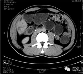鐥呯悊鍒囩墖闃呯墖澶ц禌,鐥呯悊闃呯墖姣旇禌