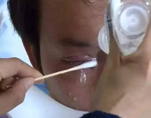 三星s6edge爆炸事件,三星s76爆炸事件