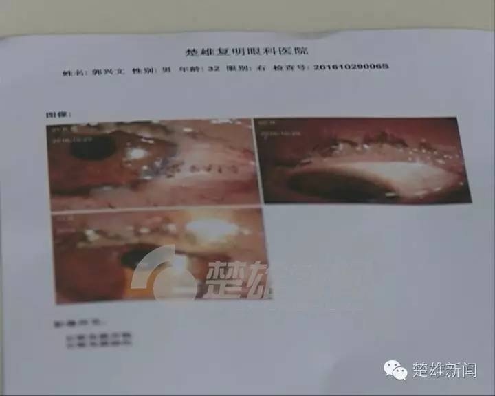 三星手机突然爆炸男子双眼被烧伤,三星发生爆炸事故