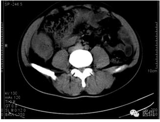 鐥呯悊鍒囩墖闃呯墖澶ц禌,鐥呯悊闃呯墖姣旇禌
