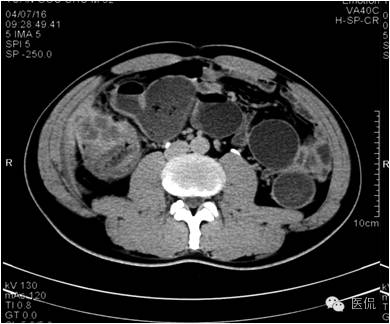 鐥呯悊鍒囩墖闃呯墖澶ц禌,鐥呯悊闃呯墖姣旇禌