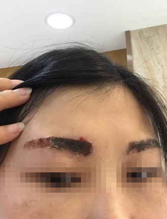 荆州一女子毁容,追踪女子后续