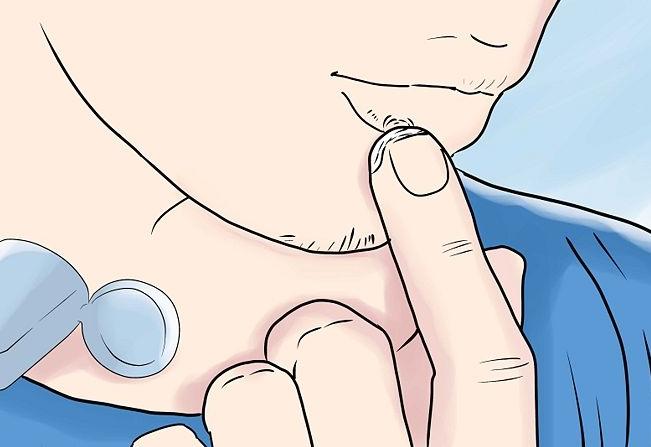 一点都不“单纯”的单纯性疱疹，中医却能轻松搞定！