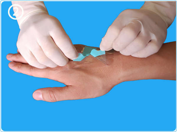 留置针方便反复穿刺的危害,留置针可以避免来回扎针吗