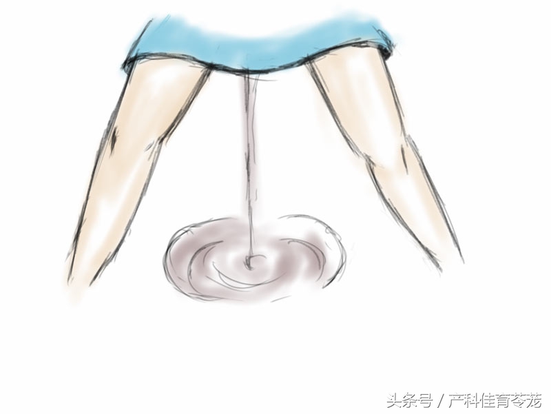 破水了，害怕吗？产科医生教您这样应对