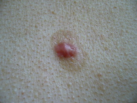 皮肤科常用药建议家中常备,7种好用不贵的药家中可常备