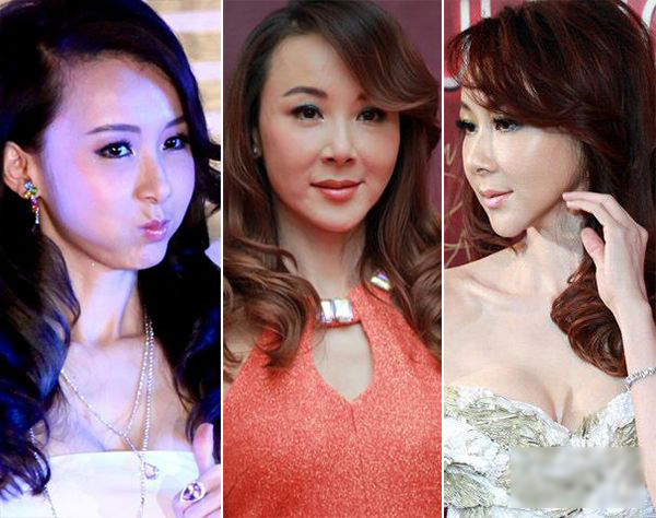 女明星整容后后遗症,女明星整容后出现后遗症