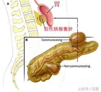 摸到肚子里有颗小圆球,摸到肚子有个圆的东西