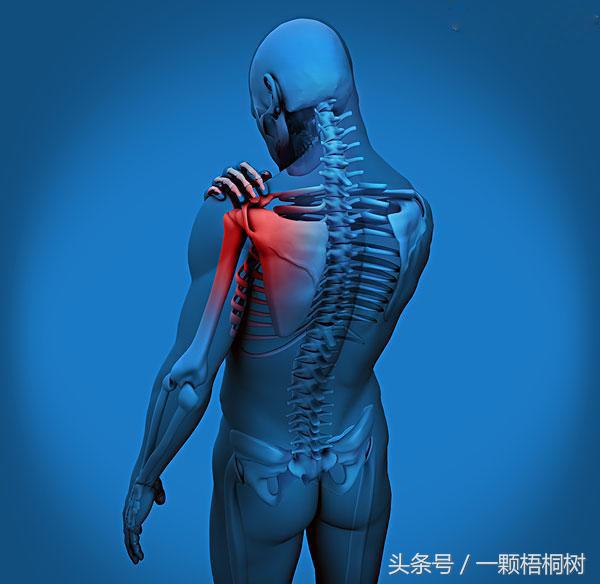 左肩周炎会引起哪些症状,肩周炎颈椎病有哪些症状