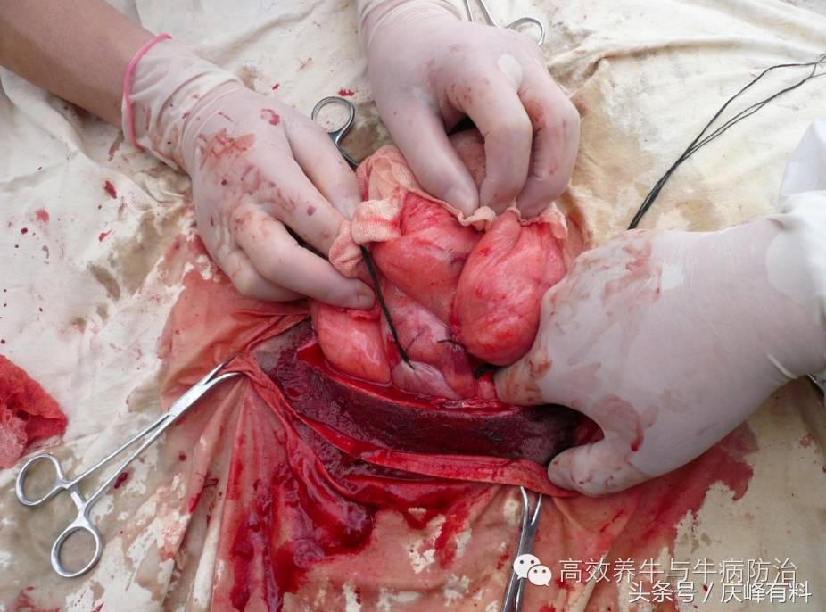 奶牛真胃扩张的症状治疗方法,奶牛皱胃左方变位治疗方法