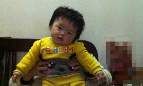 宝宝斜颈需要干预吗,宝宝斜颈家里治疗