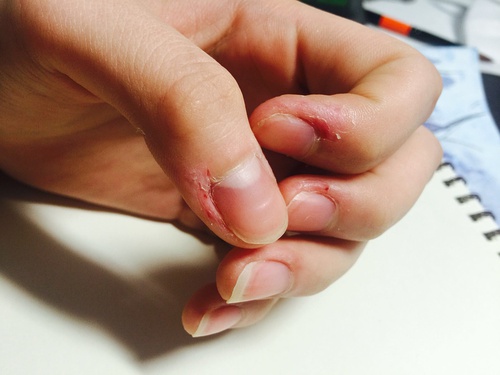 就算剁了手也改不了的小毛病！为什么就不能好好享受呢？