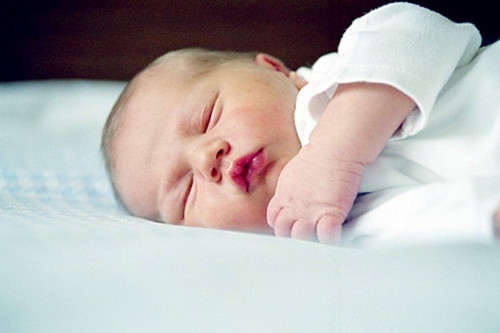 新生儿黄疸多久能退完病理性黄疸,新生儿黄疸尿黄是不是正在退黄疸