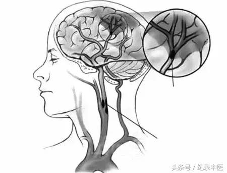 省中医吕玉波院长,广东中医院吕玉波