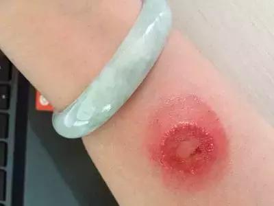 猫狗身上有癣是什么原因 (猫狗得癣)