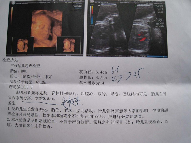 孕妈妈核磁共振检查多久出报告,孕妈妈做检查