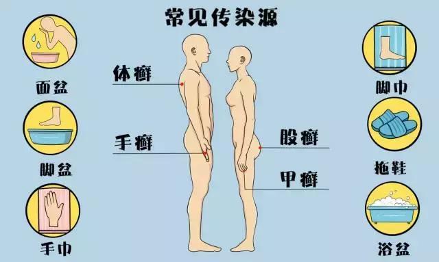 有脚气要分手吗,有脚气要不要分手