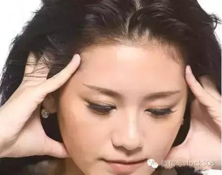 头顶稀疏发缝宽脂溢性脱发怎么办,前额头顶脱发稀疏细软怎样办