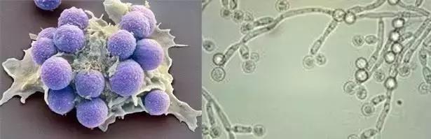 有脚气要分手吗,有脚气要不要分手