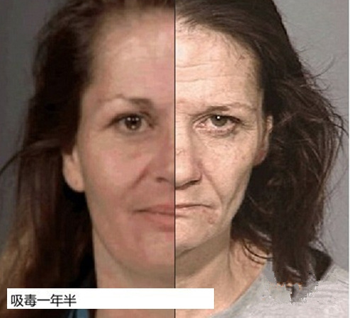 慎点！吸食*毒冰**后脸变形（组图）