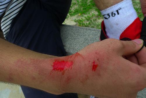 皮肤科常用药建议家中常备,7种好用不贵的药家中可常备