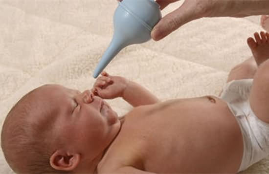 新生儿感冒鼻塞的解决小妙招,宝宝鼻炎鼻塞和感冒鼻塞怎么区分