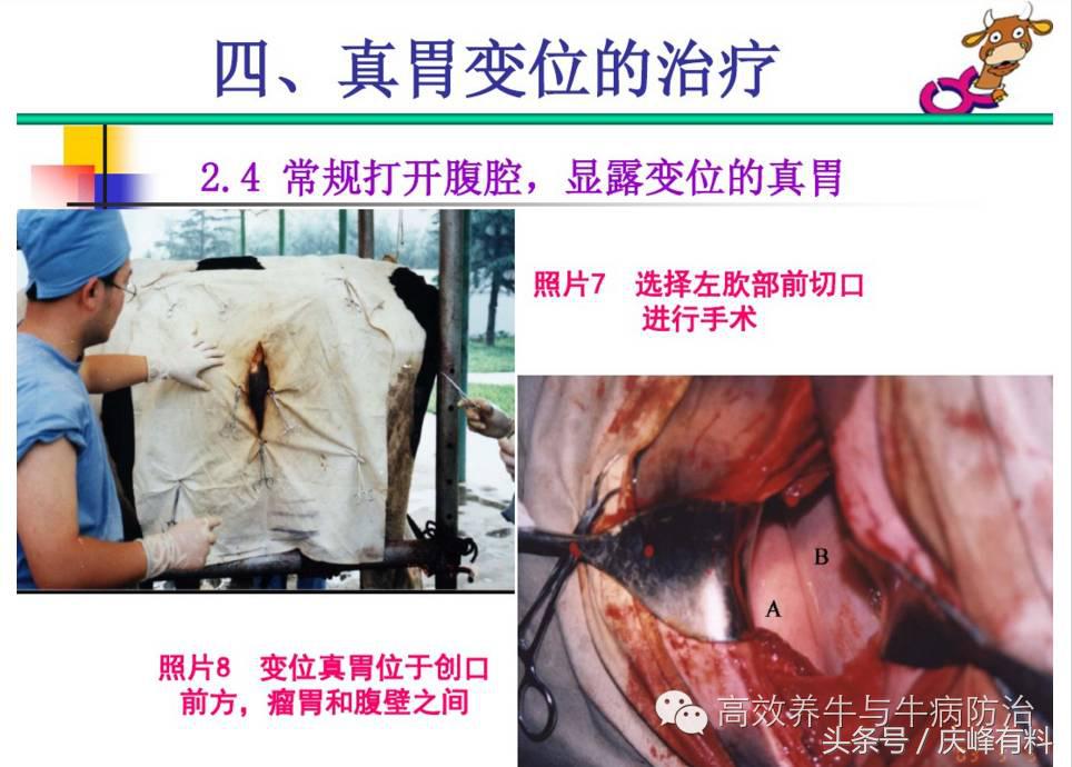 奶牛真胃扩张的症状治疗方法,奶牛皱胃左方变位治疗方法