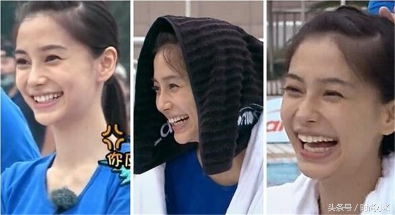 沈梦辰下巴真实照片,沈梦辰取鼻假体