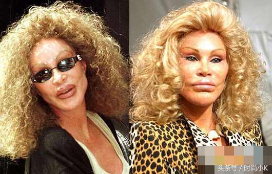 沈梦辰下巴真实照片,沈梦辰取鼻假体