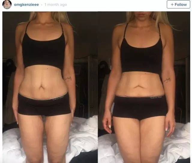 中国品味红黑榜（黑榜三）：以瘦为美，这畸形的时尚！