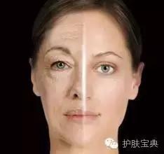 特别在意抬头纹怎么办,有人会在意抬头纹么