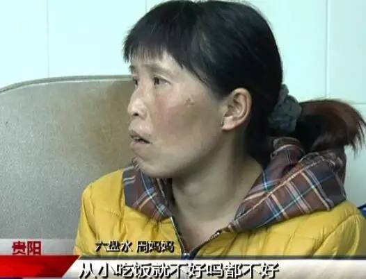 贵阳有专门儿童医院吗,贵阳市儿童医院需要预约吗