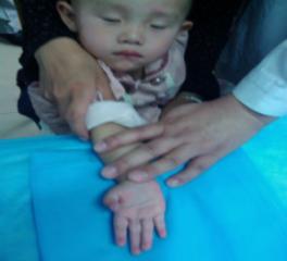 手指生锈了怎么除锈,手指感觉生锈了